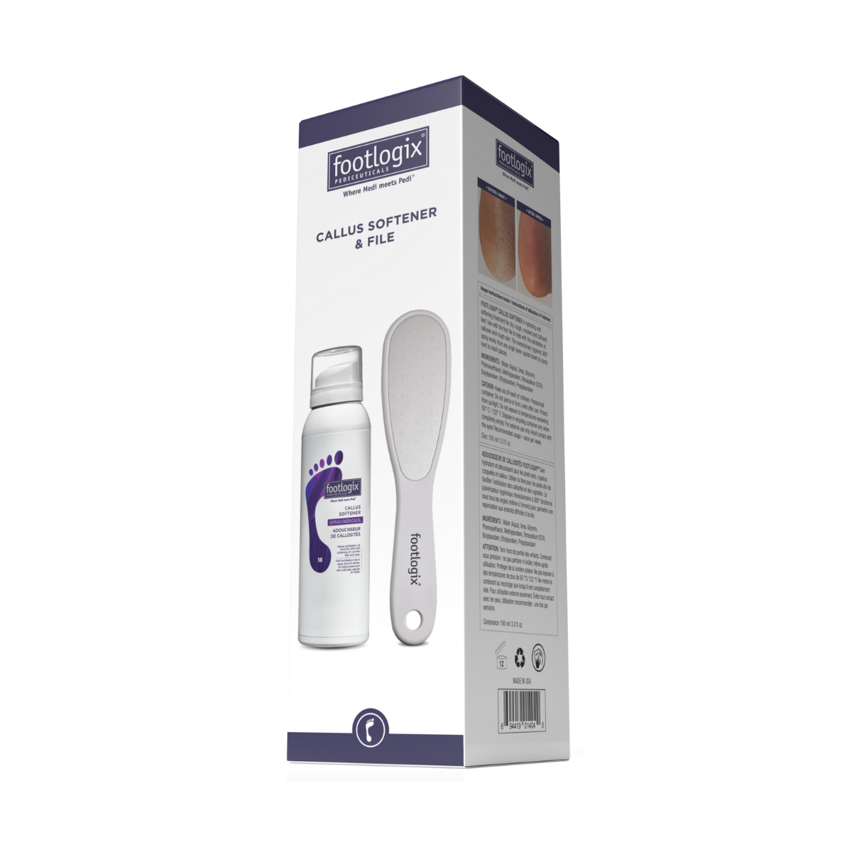 Kit de cuidado de pies Footlogix Ultimate para el hogar – Suavizante de callos y lima de pies | 100ml