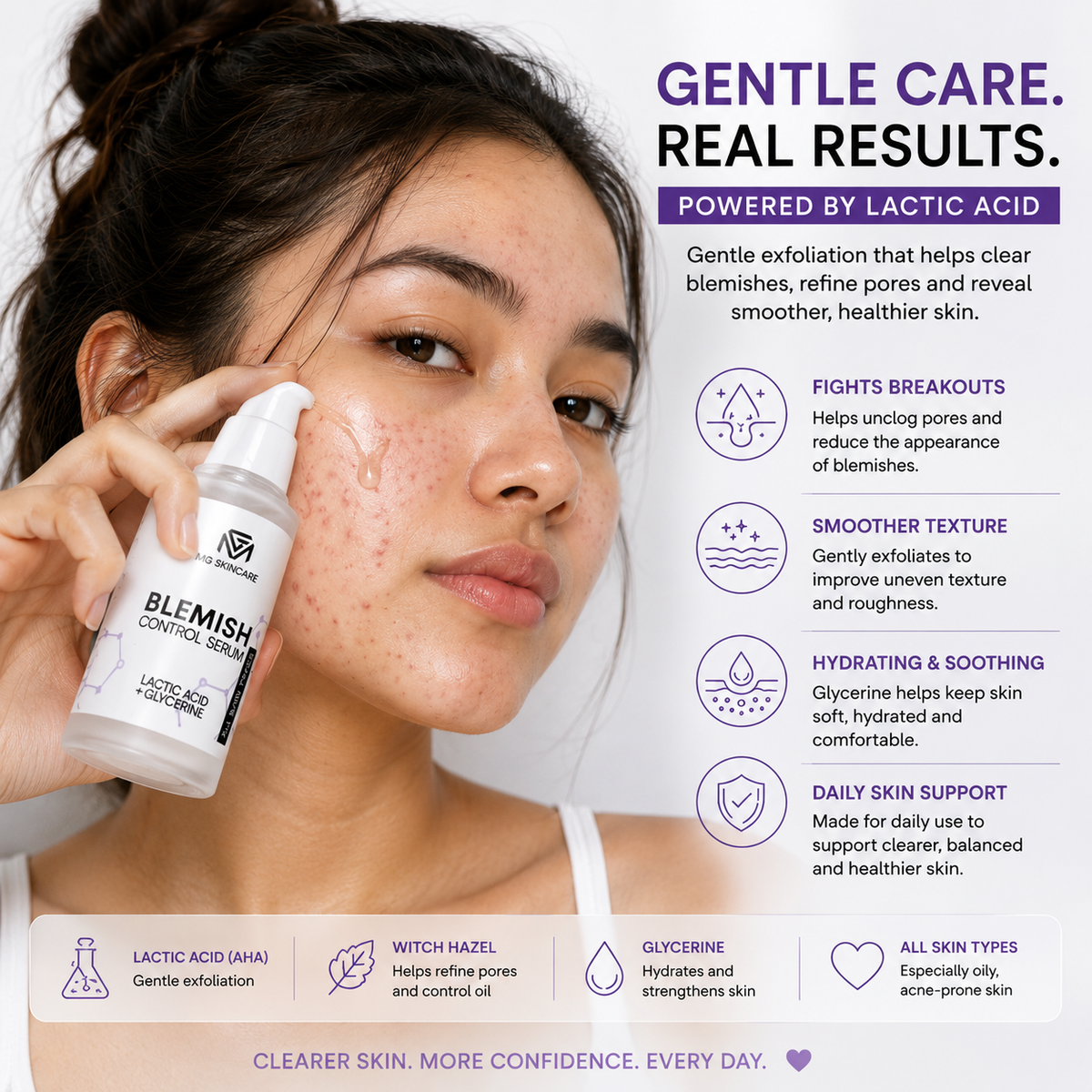 MG Skincare Lactic Acid Resurfacing Serum