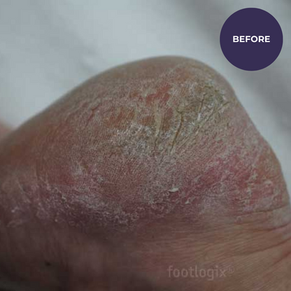 Footlogix DD Cream Mousse – Crema Hidratante Diaria para Pies | 125ml