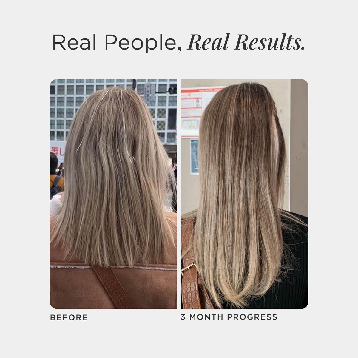JSHealth Hair Formula – Suplemento para el crecimiento capilar con zinc y yodo, 60 cápsulas