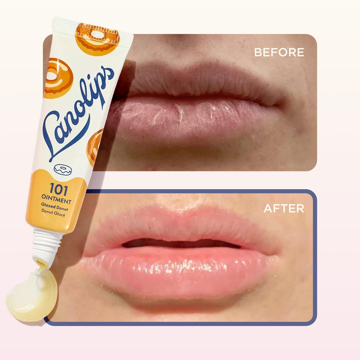 Lanolips Ungüento 101 – Glazed Donut, Bálsamo labial multiusos, 14.7 g