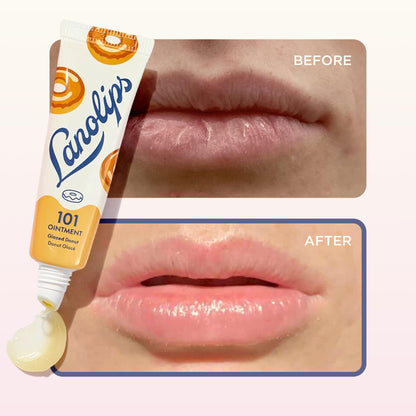 Lanolips Ungüento 101 – Glazed Donut, Bálsamo labial multiusos, 14.7 g