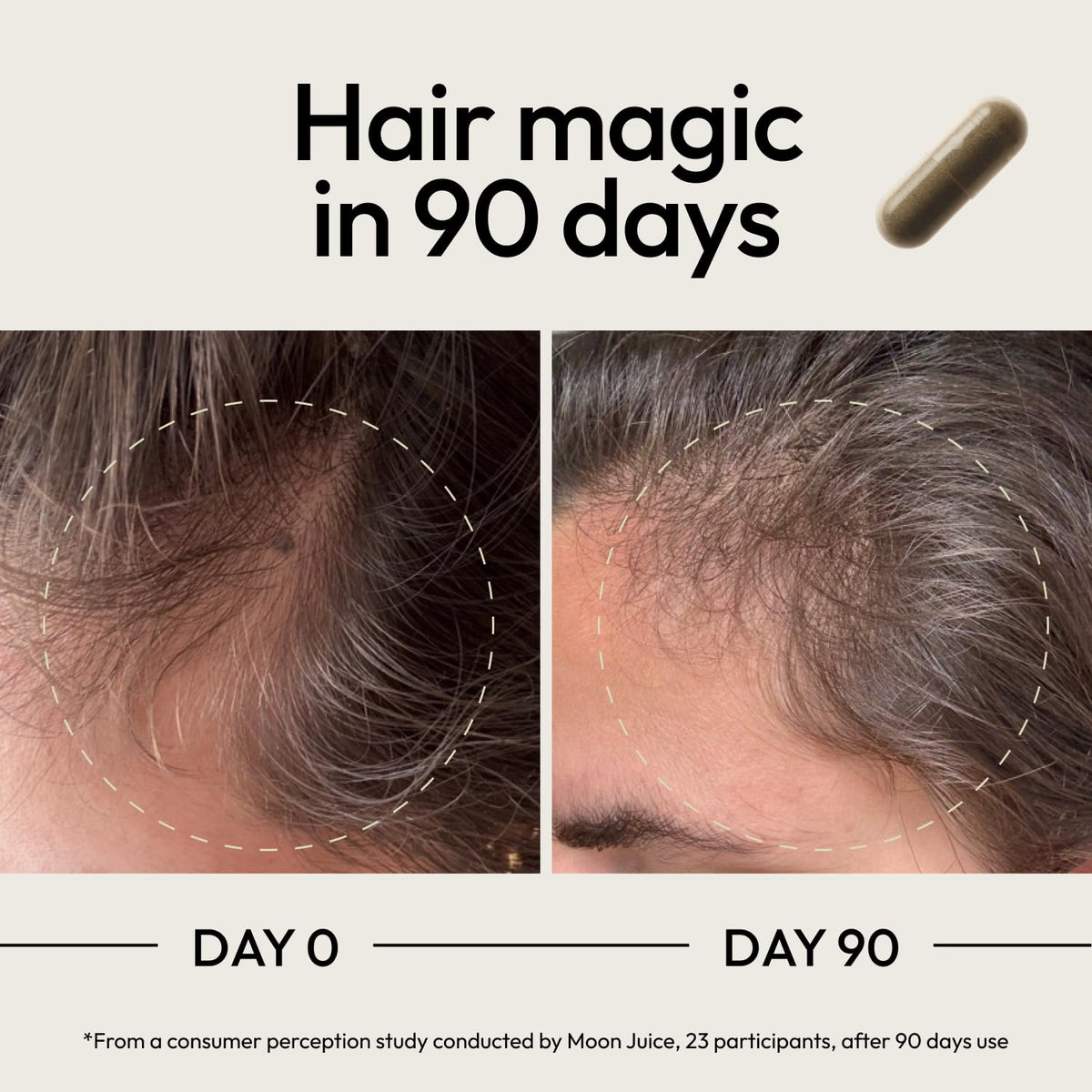 Moon Juice SuperHair – Vitaminas para el crecimiento del cabello para mujeres y hombres