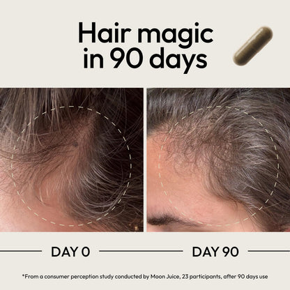 Moon Juice SuperHair – Vitaminas para el crecimiento del cabello para mujeres y hombres