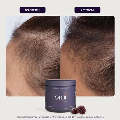 OMI WELLBEAUTY Hair Growth Peptides Gummies – Doctor Recommended, Patented Follicle Fortifying Formula