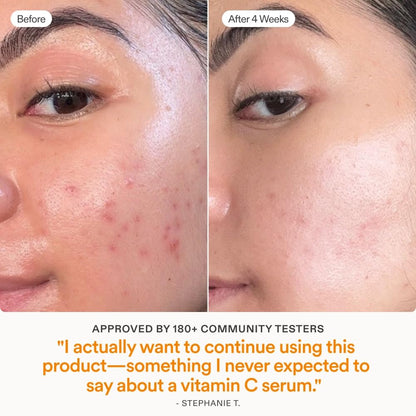 Skinfix Brighten + Firm Sérum con Vitamina C al 15% para el Rostro | Desvanece Manchas Oscuras y Líneas Finas