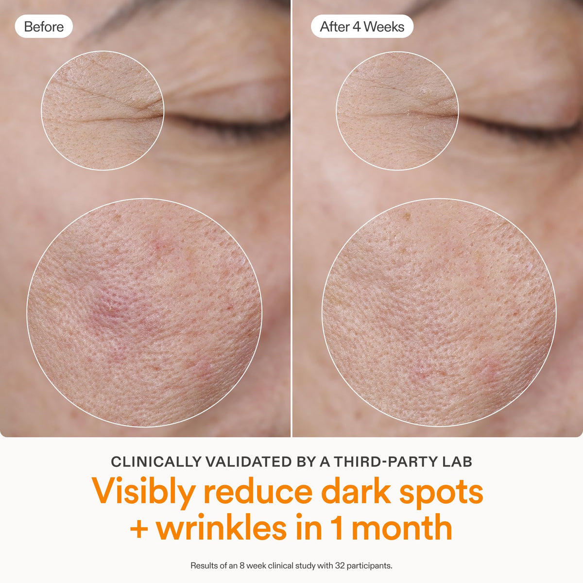 Skinfix Brighten + Firm Sérum con Vitamina C al 15% para el Rostro | Desvanece Manchas Oscuras y Líneas Finas