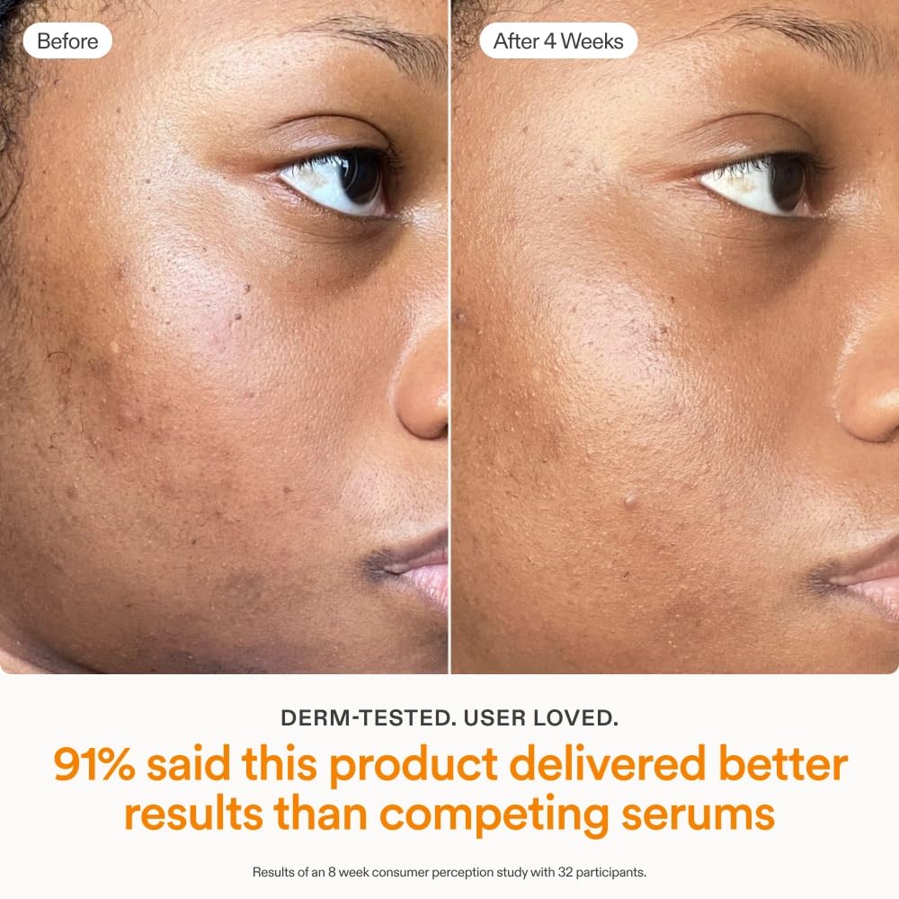 Skinfix Brighten + Firm Sérum con Vitamina C al 15% para el Rostro | Desvanece Manchas Oscuras y Líneas Finas